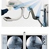 GE  OEC Elite MiniView Мобильный цифровой хирургический рентгеновский аппарат типа С-дуга